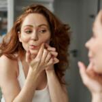 Why Do I Get Acne in the Summer - Keralam Chronicles