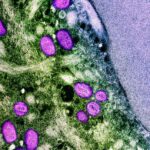 Should I be worried about mpox - Keralam Chronicles | Mpox Virus